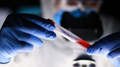 Ampulle mit Aufschrift "Coronavirus" Hände in blauen Handschuhen halten eine Ampulle mit der Aufschrift "Coronavirus"
